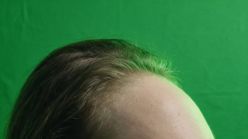Close-up of a person's hairline and shoulder against a green screen backdrop, showing a subtle green color-spill tint bleeding onto the hair and skin, a realistic chroma key edge artifact you get when you remove green screen from an image.